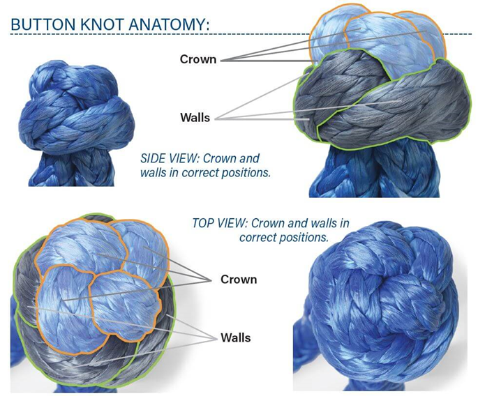 Button Knot Anatomy Button Anatomy Link-It